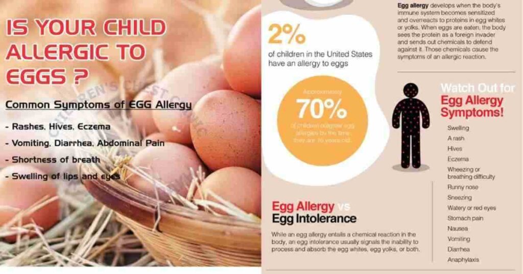 Prevalence of Egg Allergy in U.S. Children